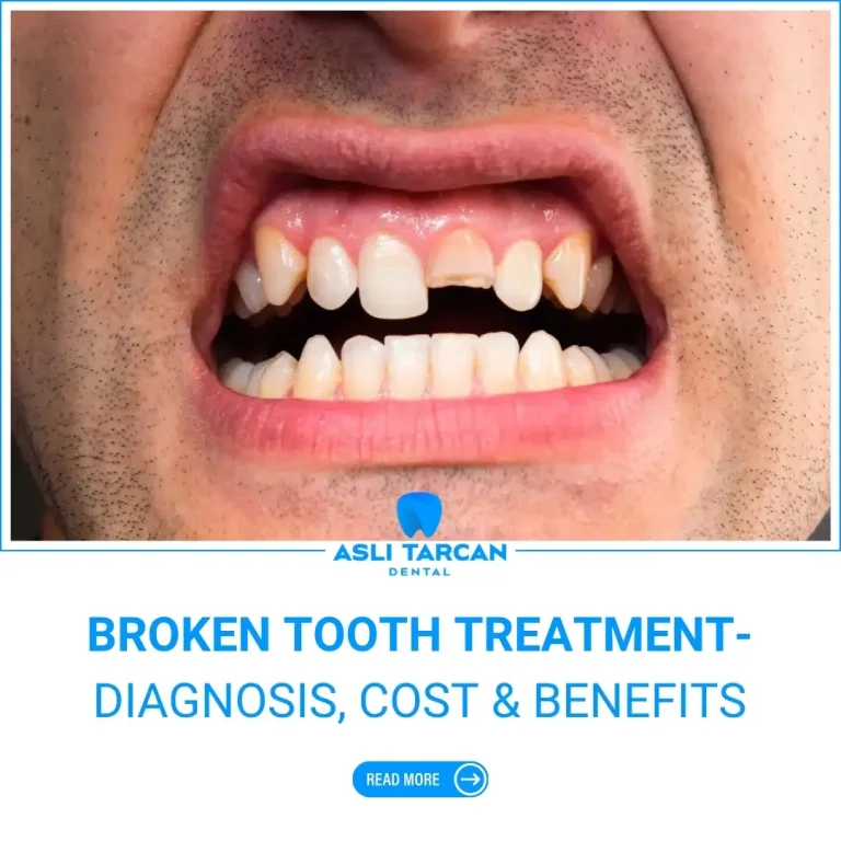 Broken Tooth Treatment-Diagnosis, Cost & Benefits