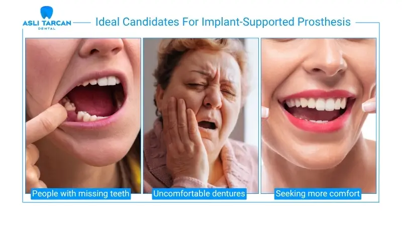 Ideal Candidates For Implant-Supported Prosthesis