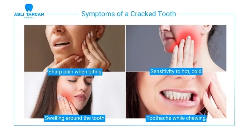 Symptoms of a Cracked Tooth
