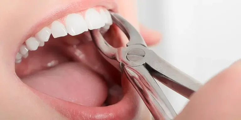 lesion tooth