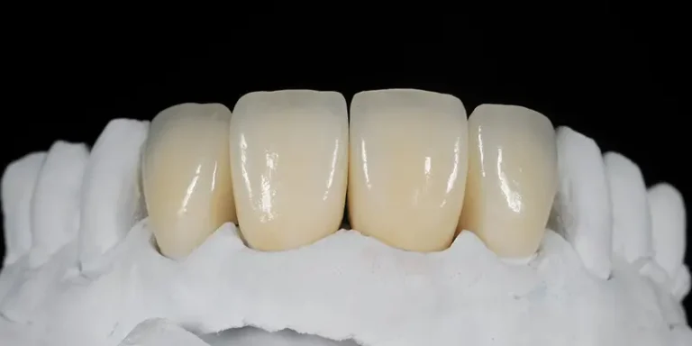 zirconium crown turkey