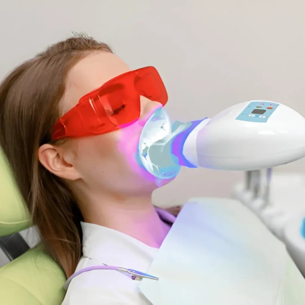Example image of teeth whitening