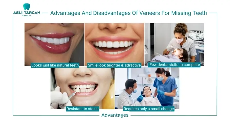 Advantages And Disadvantages Of Veneers For Missing Teeth