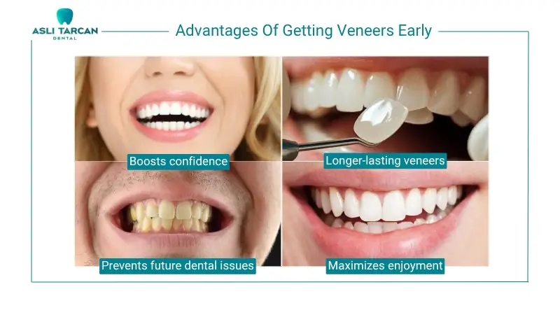 Advantages Of Getting Veneers Early