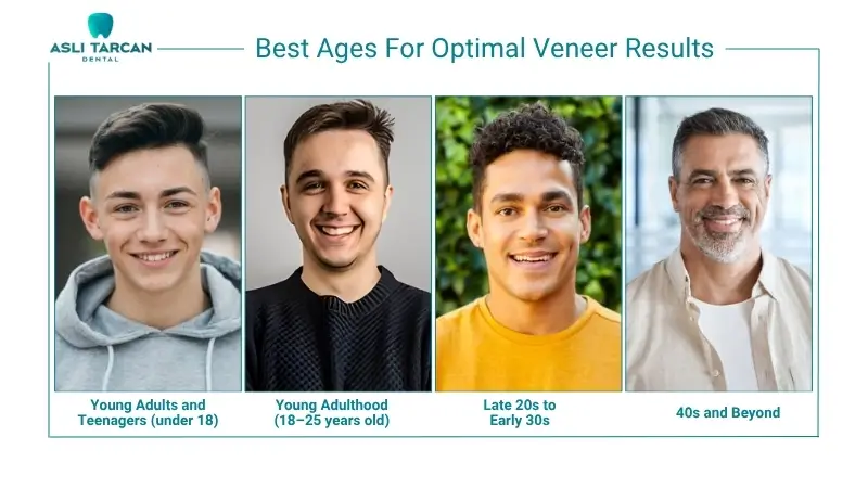 Best Ages For Optimal Veneer Results