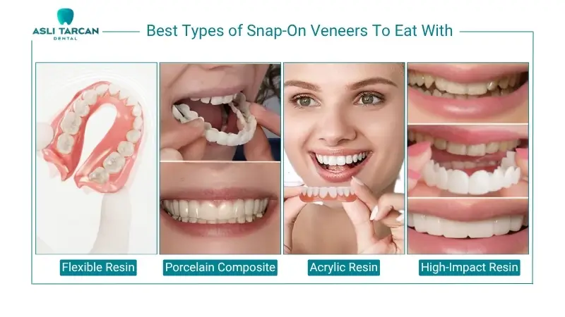 Best Types of Snap-On Veneers To Eat With