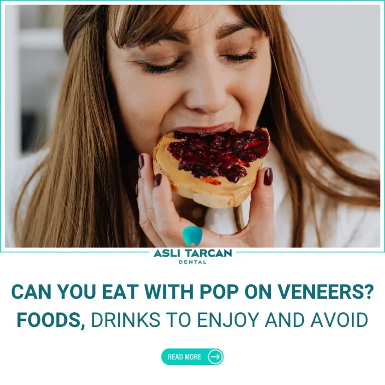 Can You Eat With Pop On Veneers Foods, Drinks to Enjoy and Avoid