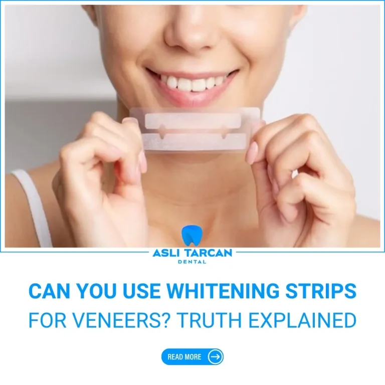 Can You Use Whitening Strips for Veneers Truth Explained