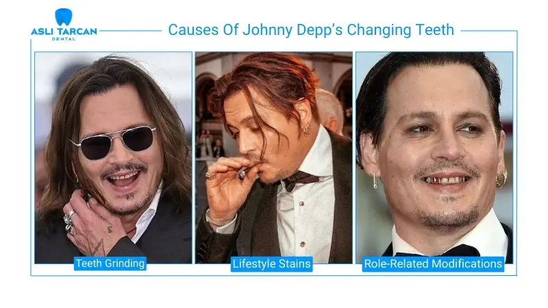 Causes Of Johnny Depp’s Changing Teeth