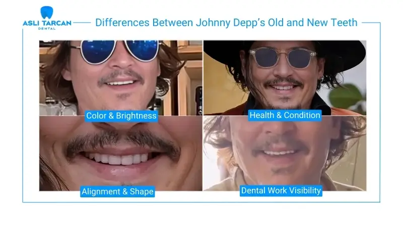 Differences Between Johnny Depp’s Old and New Teeth
