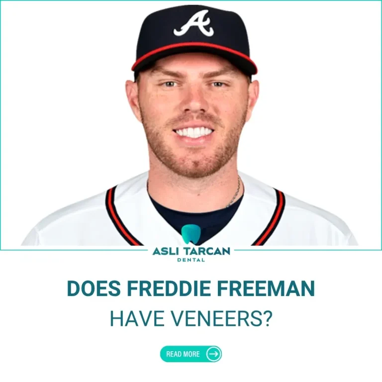 Does Freddie Freeman have Veneers
