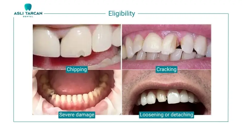 Eligibility