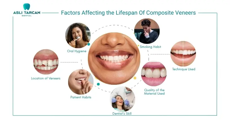 Factors Affecting the Lifespan Of Composite Veneers