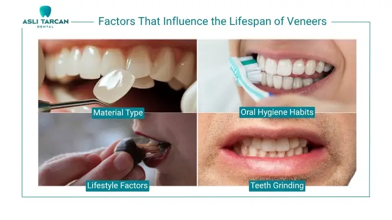 Factors That Influence the Lifespan of Veneers