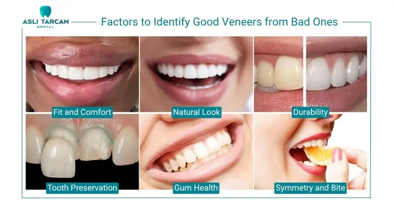 Factors to Identify Good Veneers from Bad Ones
