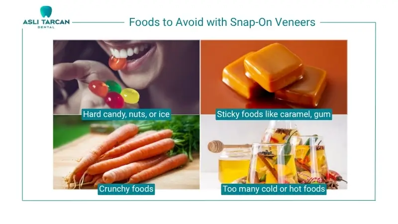 Foods to Avoid with Snap-On Veneers
