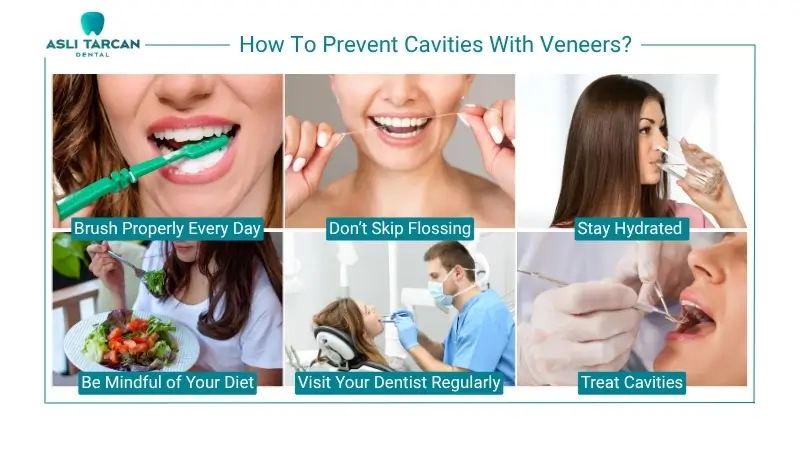 How To Prevent Cavities With Veneers