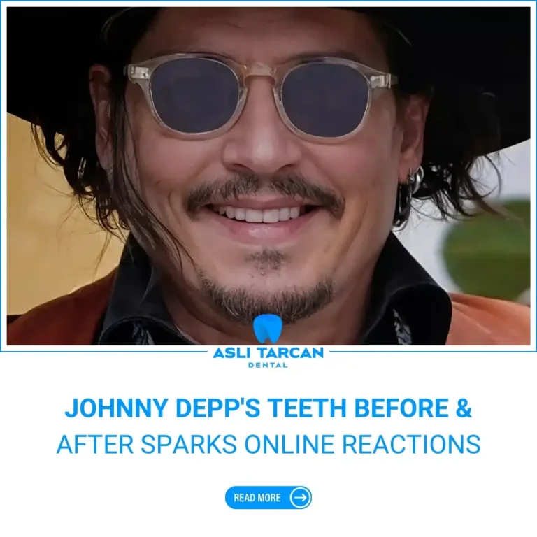 Johnny Depp Teeth Before And After Sparks Online Reactions