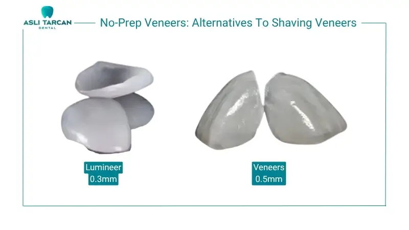 No-Prep Veneers Alternatives To Shaving Veneers