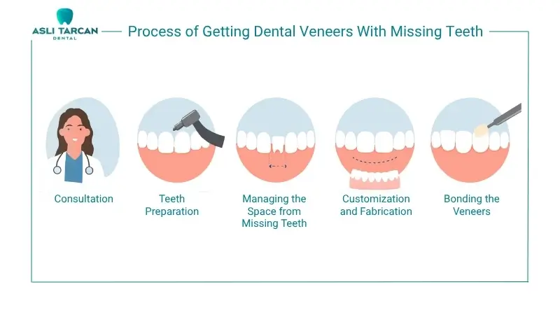 Process of Getting Dental Veneers With Missing Teeth