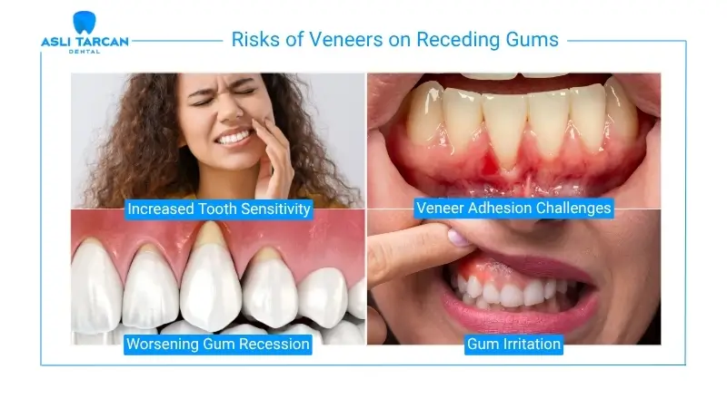 Risks of Veneers on Receding Gums