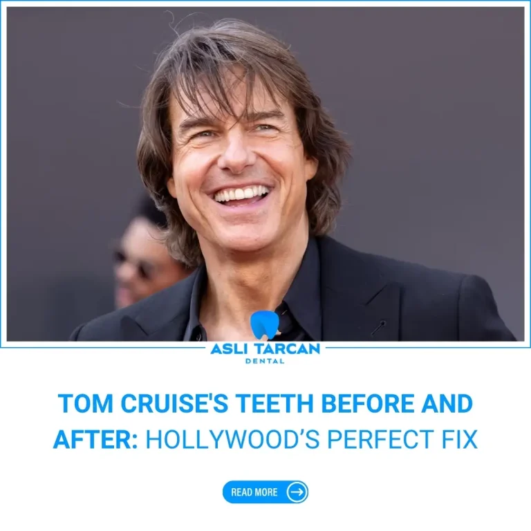 Tom Cruise's Teeth Before and After Hollywood’s Perfect Fix