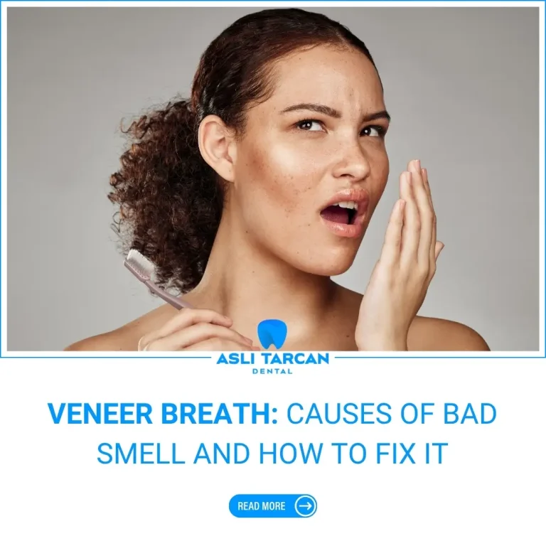 Veneer Breath Causes of Bad Smell and How to Fix It