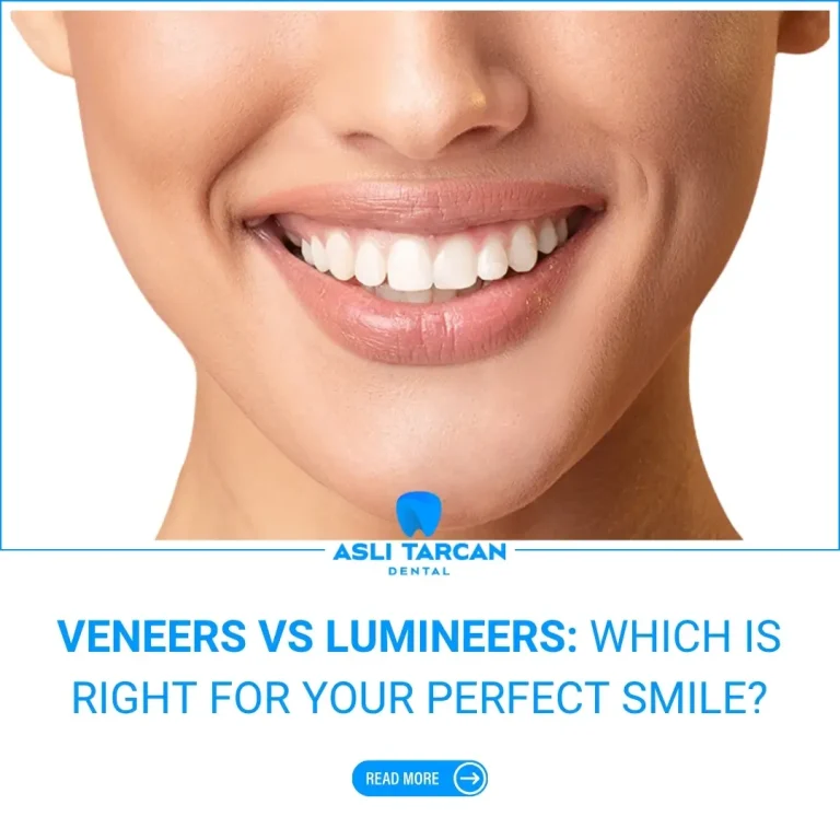 Veneers vs Lumineers Which Is Right for Your Perfect Smile