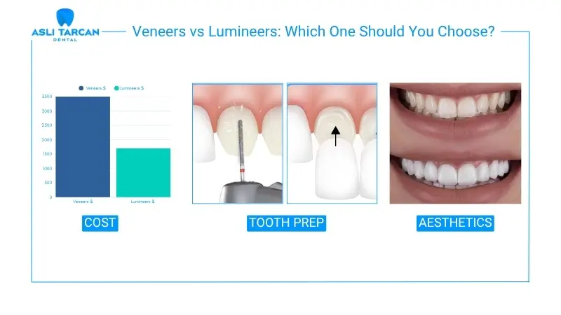 Veneers vs Lumineers Which One Should You Choose