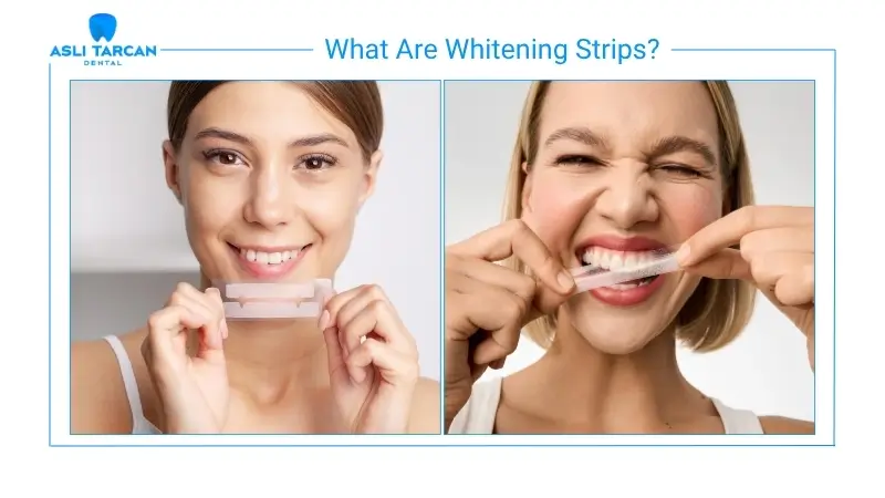 What Are Whitening Strips