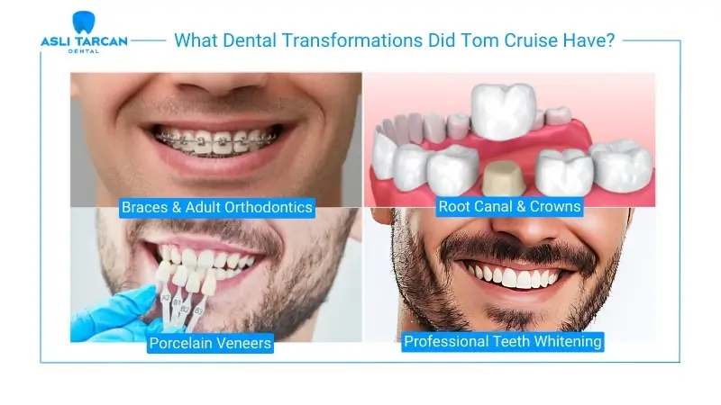 What Dental Transformations Did Tom Cruise Have