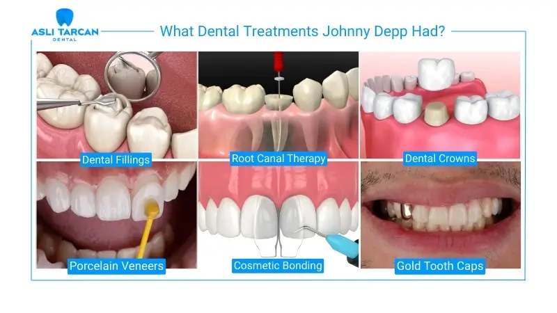 What Dental Treatments Johnny Depp Had