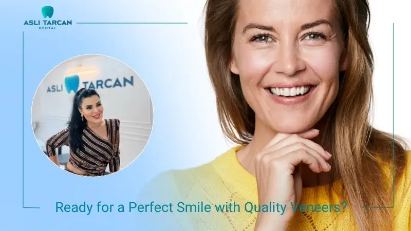 What Our Experts Say About Veneers