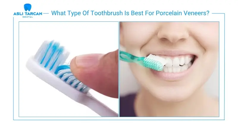 What Type Of Toothbrush Is Best For Porcelain Veneers