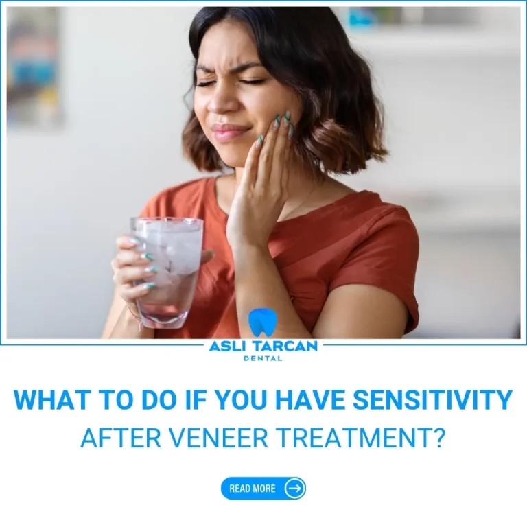 What to Do If You Have Tooth Sensitivity After Veneer