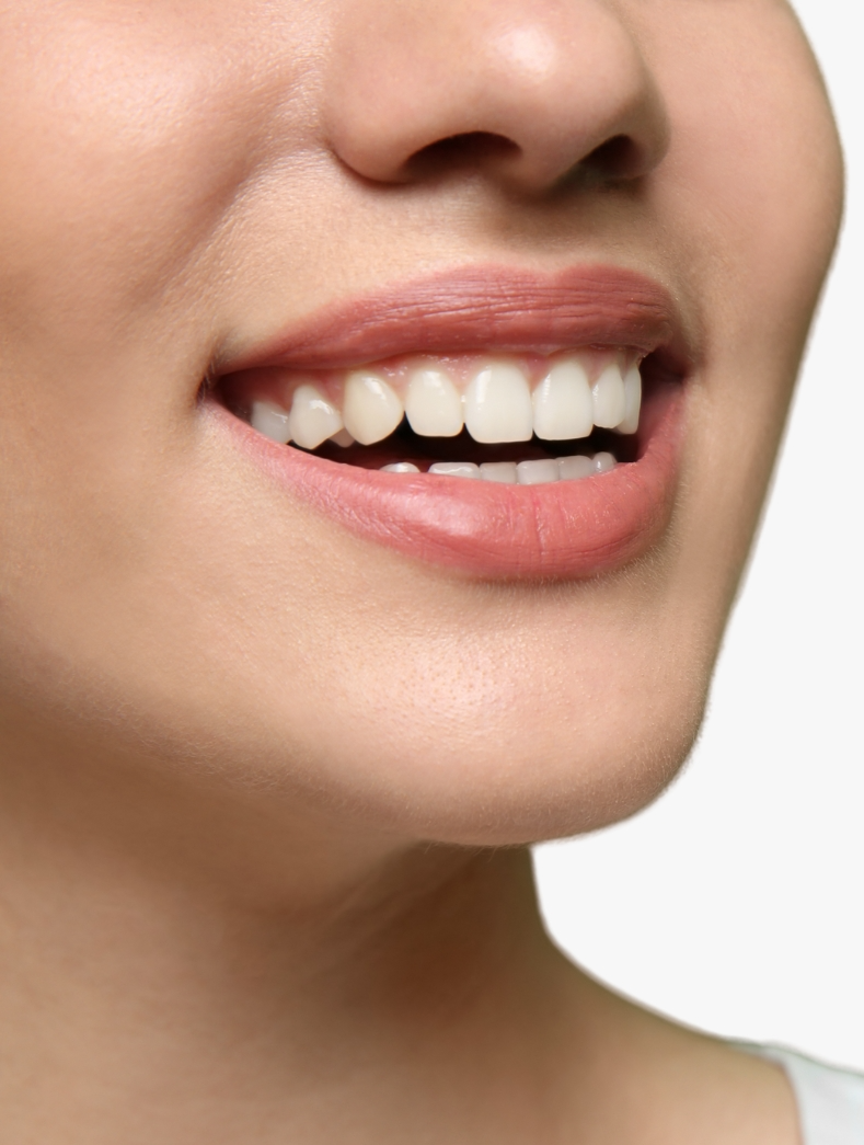 Who Are The Ideal Candidates For E-Max Dental Crowns